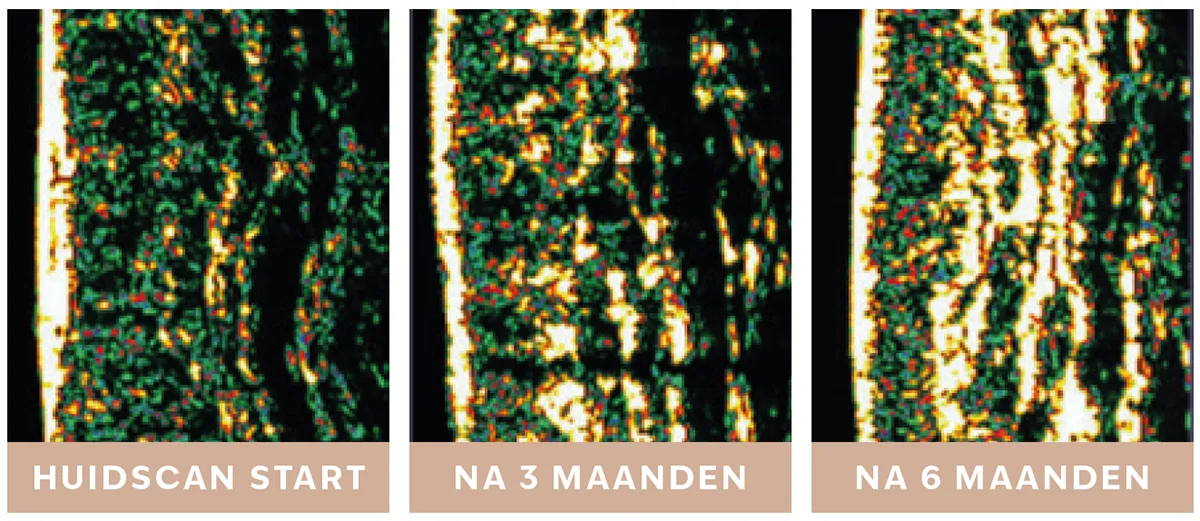 Huidscan